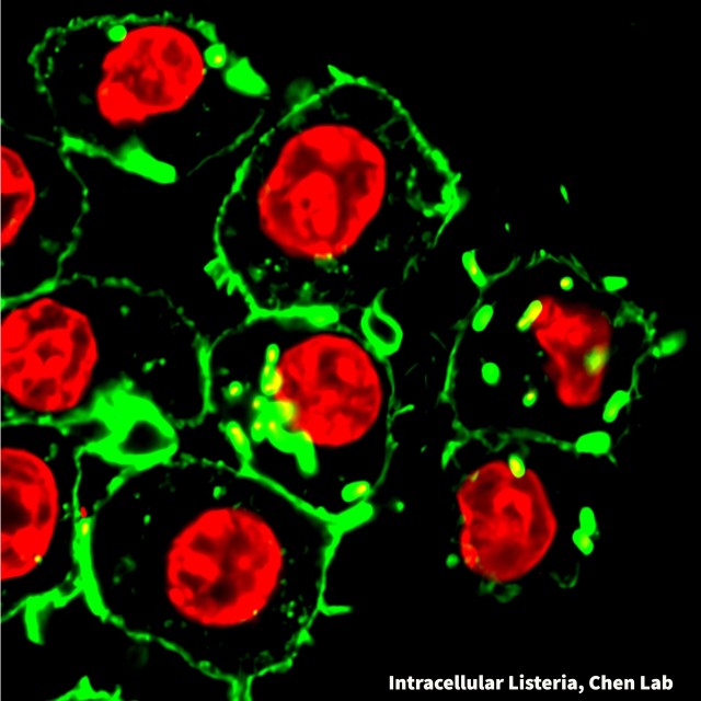 Intracellular Listeria, Chen Lab